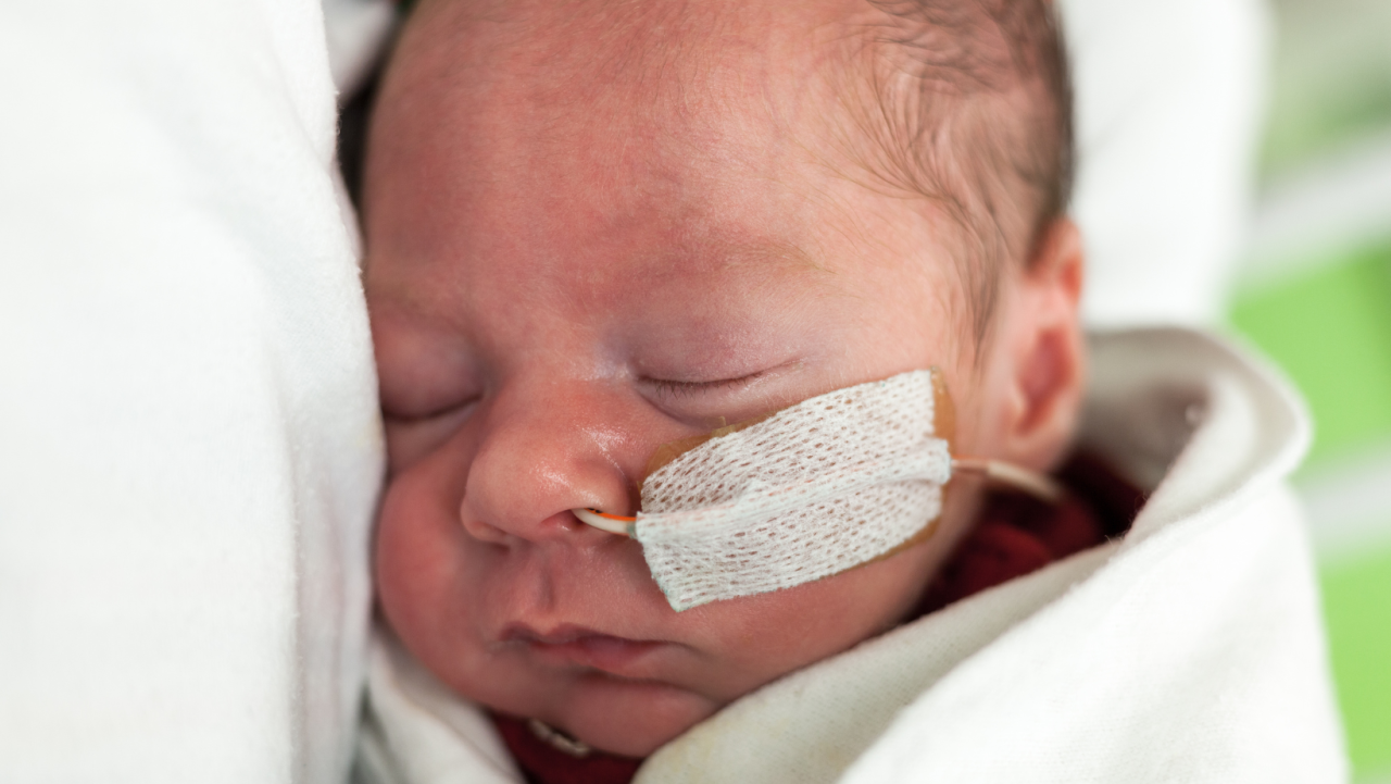 newborn with feeding tube